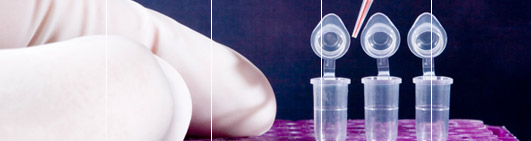 DNA Forensic Testing including Hair DNA Test. Specialised service.
